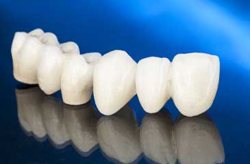Dentist Browns Plains Treatments & Services - Restorative Dentistry Browns Plains