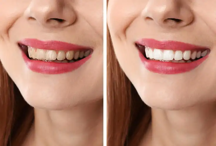 Cosmetic Dentistry also include color, position, shape, size, alignment and overall appearance.