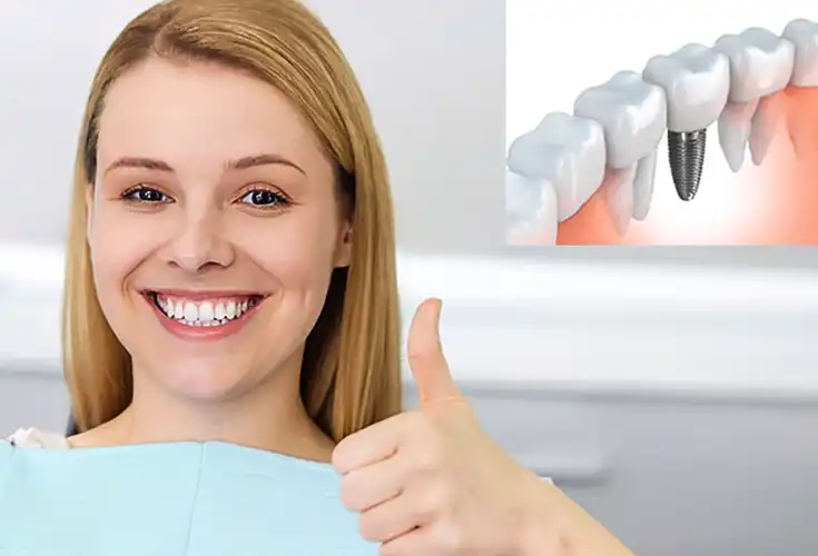Dental Implants Browns Plains