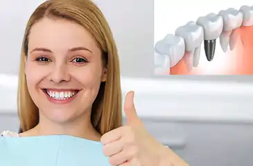 Dental Implants
