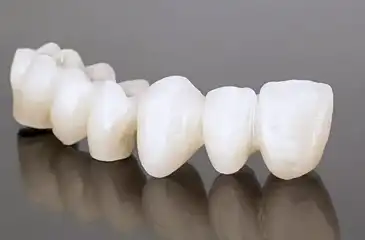 Dentist Browns Plains Treatments & Services - Restorative Dentistry Browns Plains