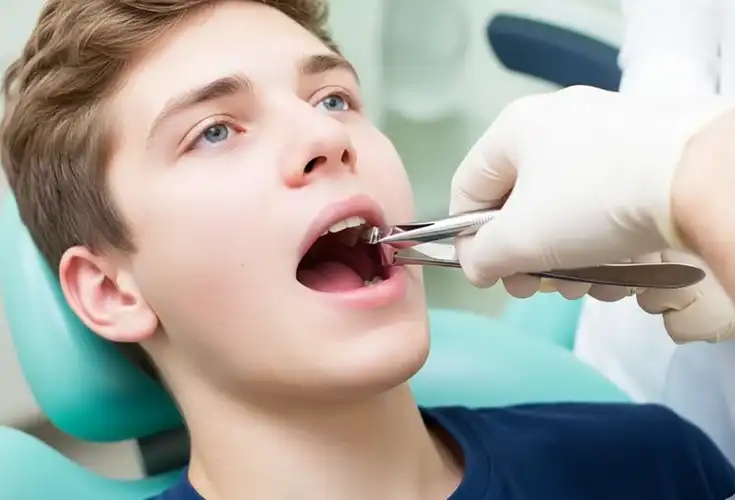 Wisdom Teeth Removal